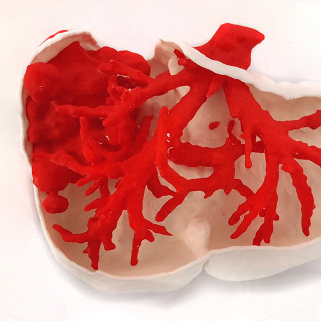 生物醫學團隊「Mirai3D」將3D列印結合虛擬模擬技術，使用獨立雙噴頭系統開發生物醫學模型，術前規劃流程，完整過程馬上看！